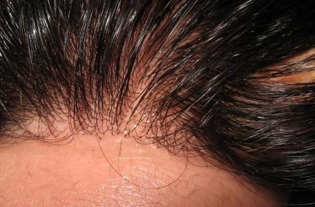 HD Film Lace / Illusion Lace Closure - 6x6 - Exotic Hair Shop